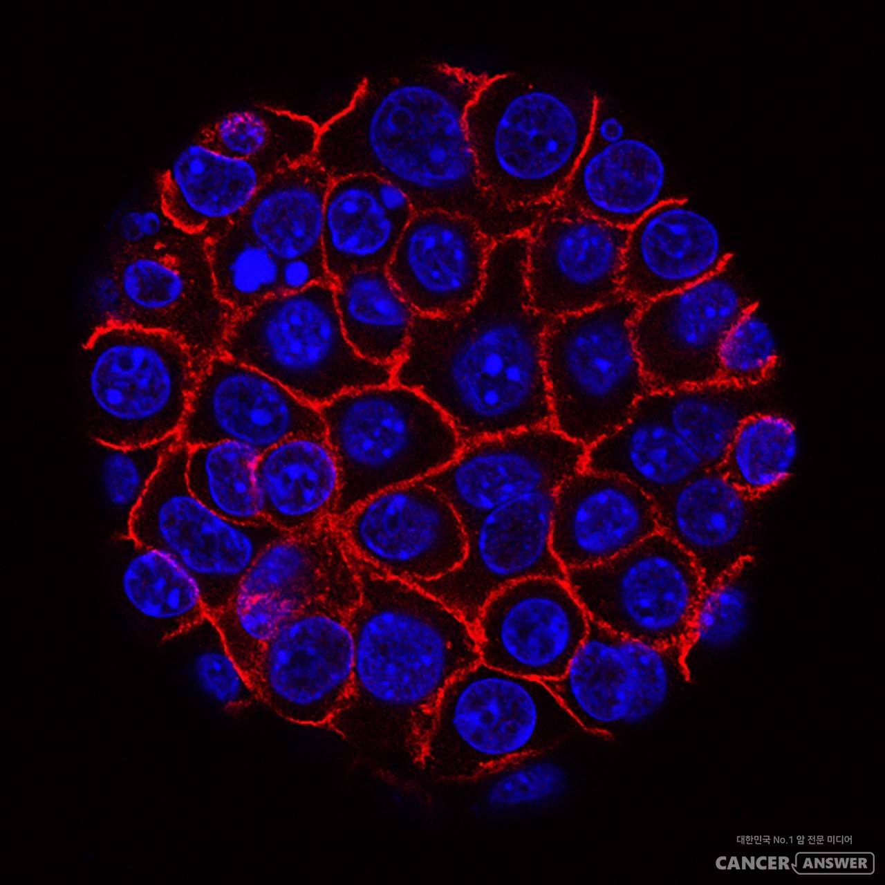 미국 국립암연구소가 찍은 췌장암 세포. / unsplash