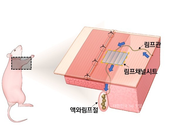 림프절이 절제된 소동물 모델에 림프채널시트를 이식한 결과, 끊어진 림프의 흐름이 회복되는 것을 확인할 수 있다. /서울아산병원