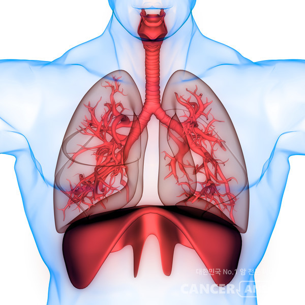폐암에서 쓰이는 면역항암제로는 키트루다와 티쎈트릭, 옵디보, 임핀지 등이 있다. /게티이미지뱅크