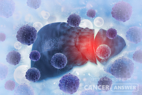 간내 담도암은 60~80대 나이 든 사람에게 많이 발생한다./게티이미지뱅크