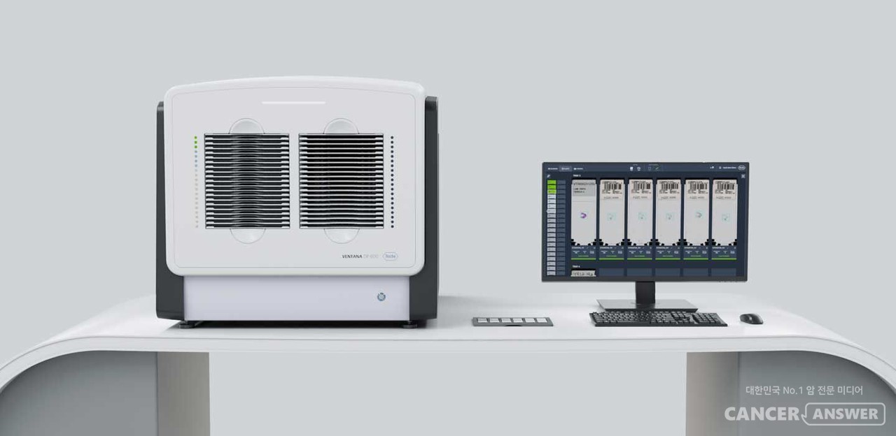 한국로슈진단의 벤타나 디피(VENTANA DP) 600 슬라이드 스캐너.