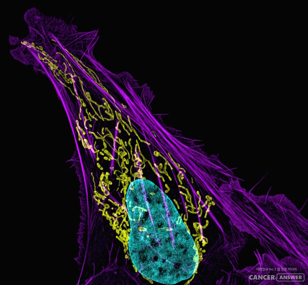 원발암세포에서 떨어져 나가 전이암의 씨앗이 되는 암세포 클러스터를 분리해 내 전이암을 미리 찾아낼 수 있는 마이크로칩이 개발됐다. 사진은 암세포의 확산 모습. / unsplash.