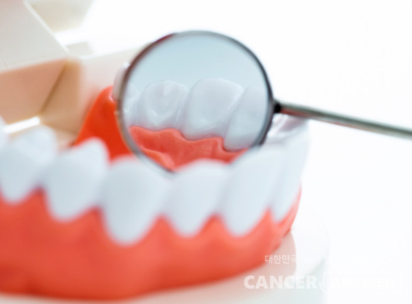 잇몸병을 앓는 이들은 그렇지 않은 이들에 비해 암 발생 위험이 13% 높다는 연구 결과가 발표됐다. /게티이미지뱅크