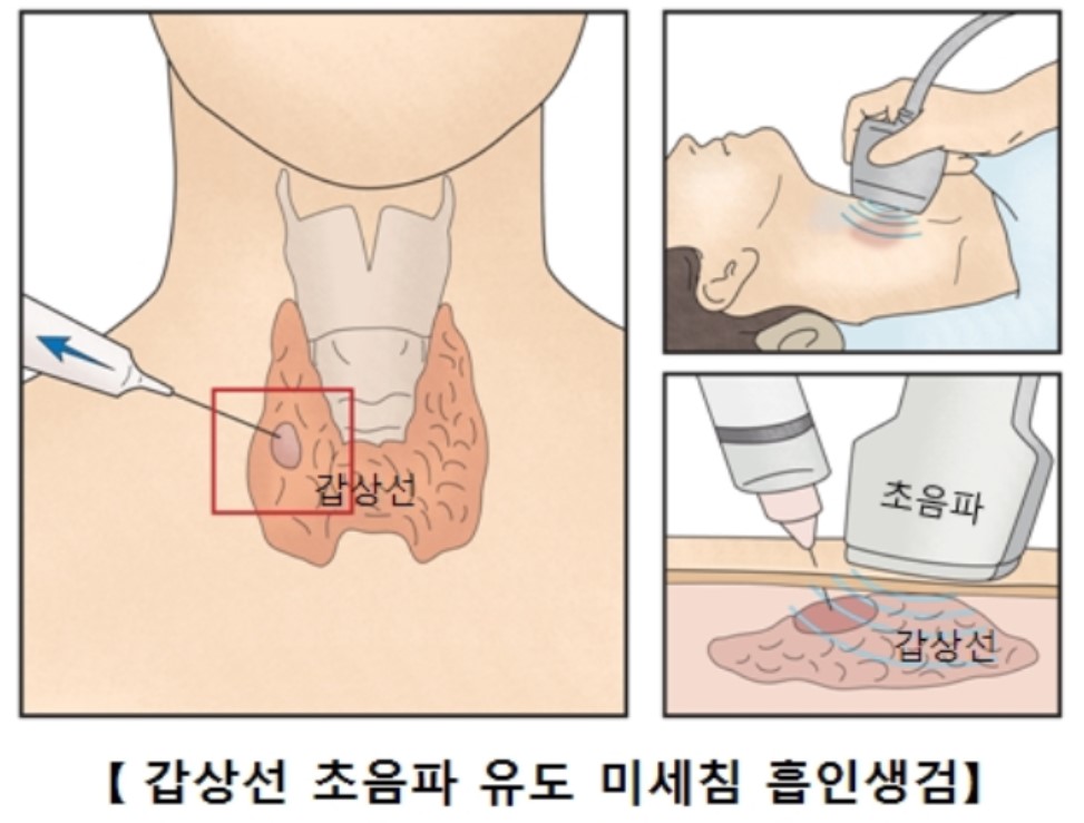자료 서울아산병원