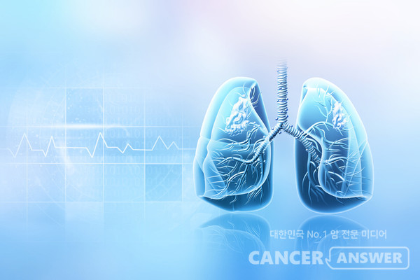 마른기침과 호흡곤란이 계속되는 사람은 특발성 폐섬유화증을 의심해봐야 한다./게티이미지뱅크