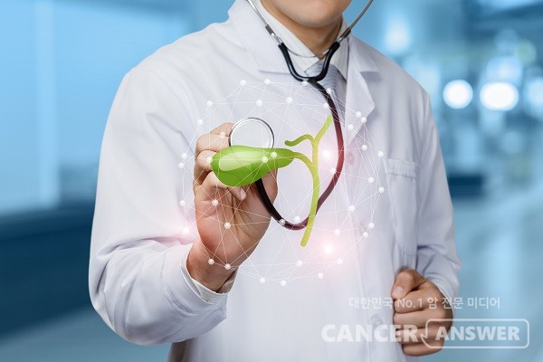 담도암 조기 진단에 협대역 내시경 검사가 유용하다는 사실을 국내 의료진이 세계 최초로 규명했다./게티이미지뱅크