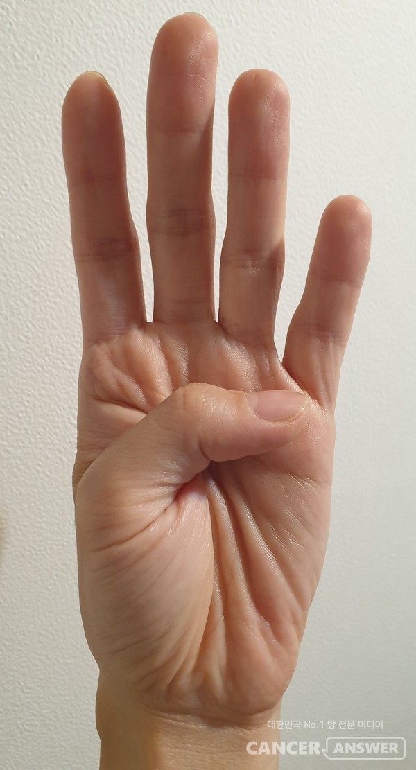 엄지손가락 접기 /캔서앤서