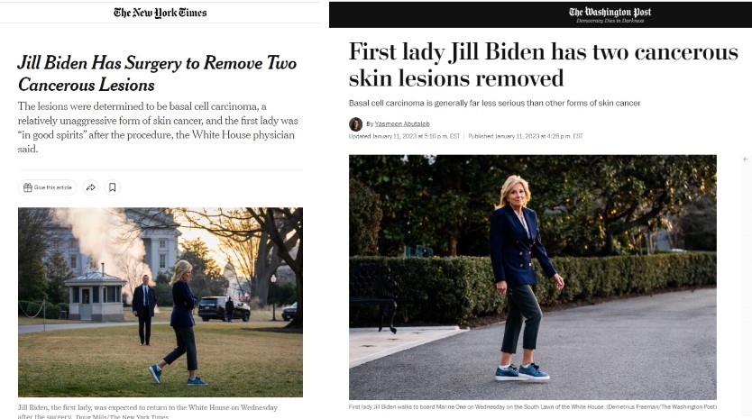 질 바이든 여사의 암종 제거 수술 소식을 전하고 있는 미국 언론들.