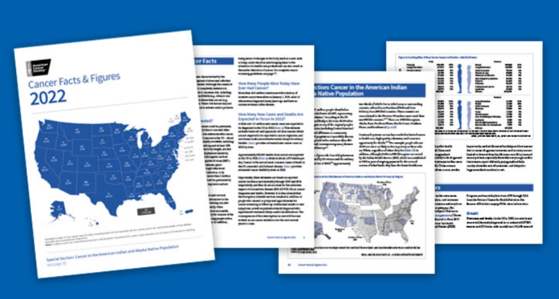 미국의 암 사망률이 30년간 33% 줄었다는 통계가 담긴 미국 국가 규모의 보고서.