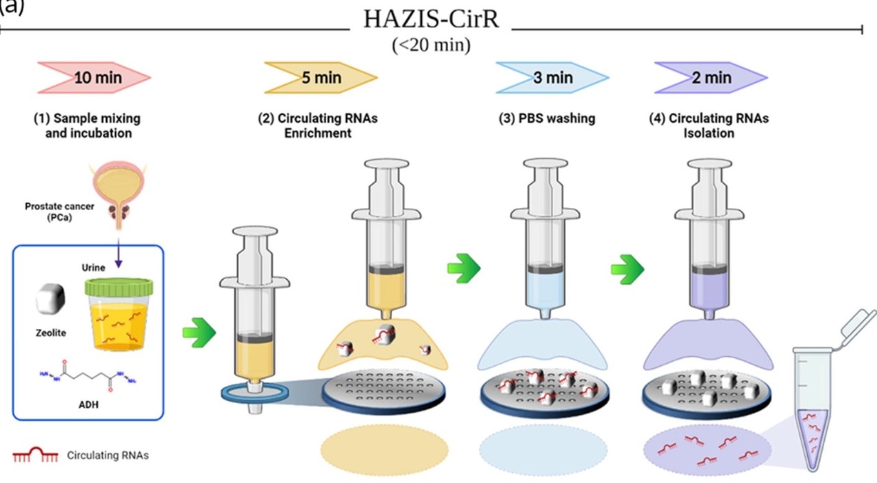 소변을 20분 정도 검사하는 것만으로 암 환자 여부를 판정할 수 있는 획기적인 '액체생검' 방식이 국내 연구팀에 의해 개발됐다. 간단한 도구만으로 쉽게 검진할 수 있어 학계의 주목을 받고 있다.