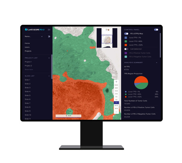 의료 인공지능(AI) 기업 루닛은 1일 미국 바이오헬스케어 기업 가던트헬스와 협업해 완성한 AI 기반 병리분석 솔루션 ‘가던트360 티슈넥스트’를 공개했다. 사진은 루닛의 AI 기반 병리분석 솔루션 루닛 스코프 PD-L1./루닛 제공)