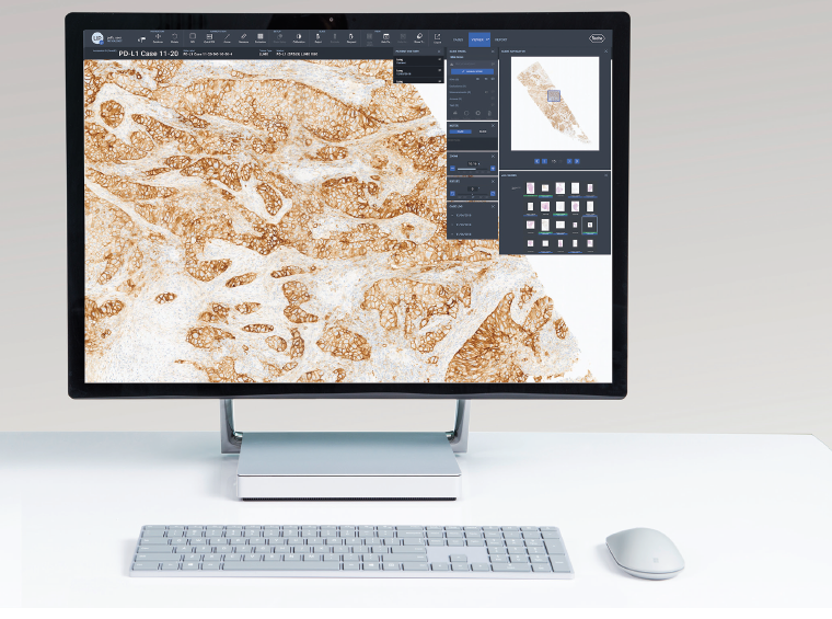 uPath에서 PD-L1(SP263) 케이스를 시연 중인 모습. / 한국로슈진단