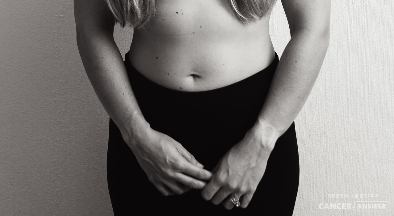 대사증후군이 있으면 자궁경부암 유발 바이러스 감염 위험이 높아져 반드시 자궁경부암 정기검사를 정기적으로 받아야 한다. / unsplash