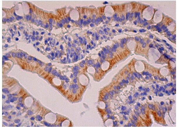 G-CSF 항체 모형.