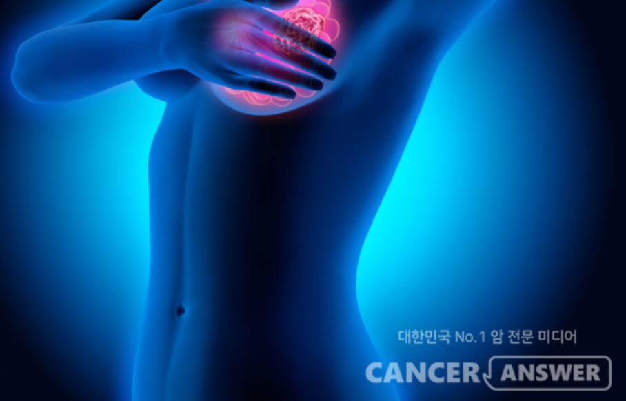 단백질 라이브러리와 AI 기술 접목해 유방암 조기 진단한다는 혈액검사 모델을 베르티스가 개발했다./캔서앤서DB