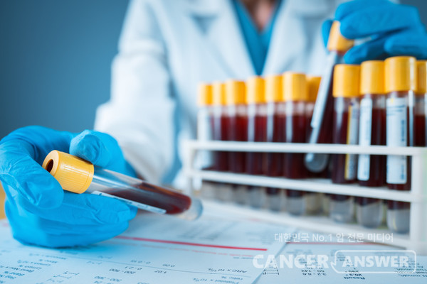 연세암유방암 유전자를 혈액 검사만으로 정확하게 진단하는 ‘전장유전체 순환종양 DNA(ctDNA) 분석법’을 국내 연구진이 개발했다./캔서앤서 DB