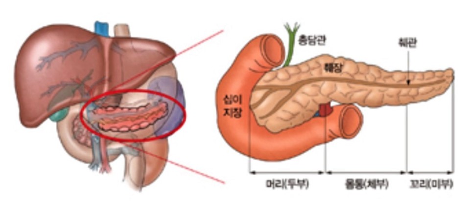 췌장암 환자가 80세 이상의 고령이라도 수술을 하는 게 잇점이 더 많다는 국내 연구가 나왔다. 