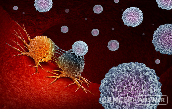 면역항암제 치료가 잘 듣지 않는 이유는 ATXN3 유전자가 PD-1, PDL-1과 같은 단백질을 발현시켜 암세포가 면역항암제의 공격을 피하기 때문이라는 해외 연구 결과가 나왔다. / 게티이미지뱅크