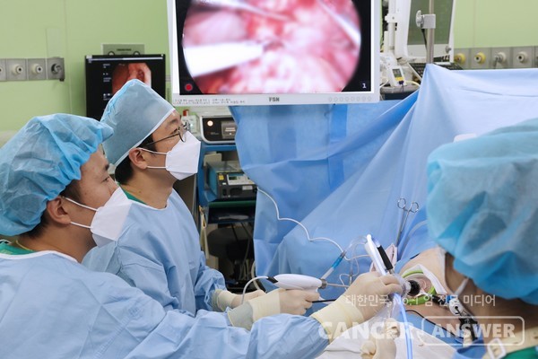 고창석 서울아산병원 위장관외과 교수(왼쪽 두번째)가 진행성 위암을 진단받은 고령 환자를 수술하고 있다./서울아산병원 제공