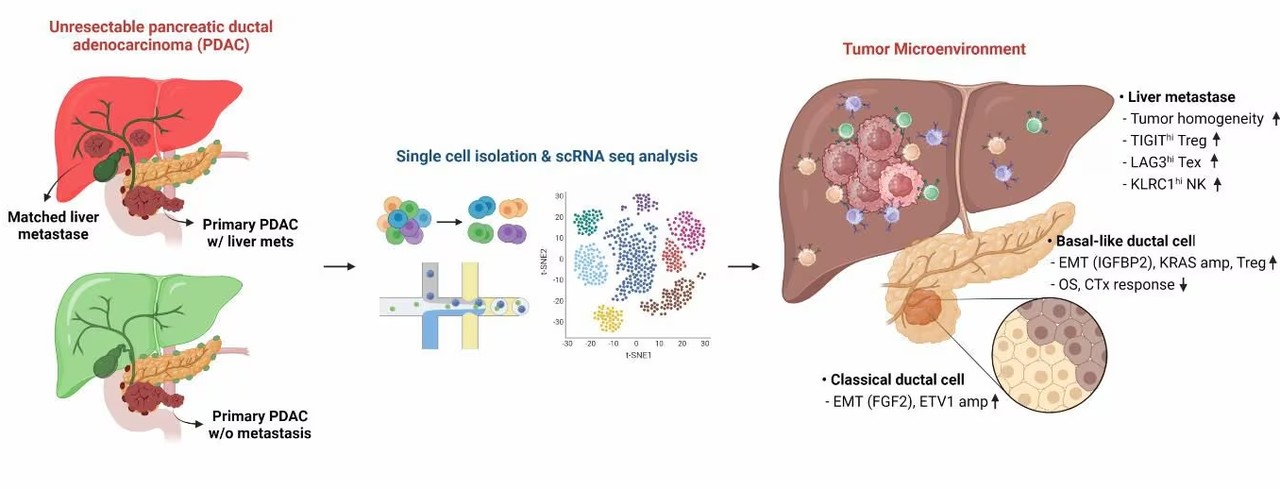 단일 세포 전사체 분석을 통해 확인한 췌장암의 간 전이와 미세환경 변화 등을 나타낸 모식도. /삼성서울병원 제공