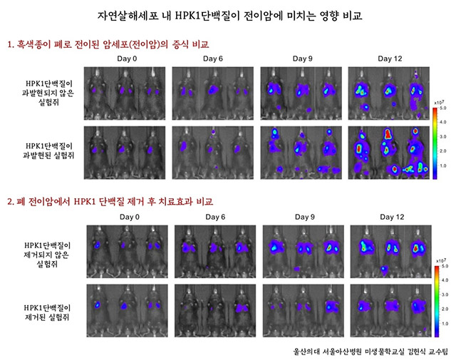 자연살해세포(NK세포_ 내 HPK1 단백질이 전이암에 미치는 영향을 비교한 그래픽./서울아산병원 제공