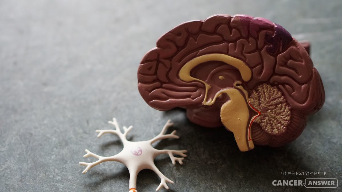 한국생명공학연구원 마이크로바이옴융합연구센터 이정수 책임연구원 연구진은 한국과학기술연구원 류훈 박사 연구팀, 미국 보스턴 의과대학 이정희 교수 연구팀과 함께 발로신 함유 단백질(Valosin-Containing Protein, VCP)이 알츠하이머의 원인이 되는 타우단백질을 어떻게 제거하는지 알아냈다고 18일 밝혔다./캔서앤서DB