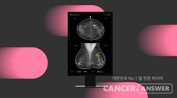 인공지능(AI)을 이용하면 유방암 발견 가능성이 높아진다는 점이 국내 6개 대학병원에서 시행한 대규모 연구에서 확인됐다. 의료AI 기업 루닛은 유방촬영술 AI 영상분석 솔루션 ‘루닛 인사이트 MMG’를 활용한 대규모 다기관 전향적 연구 결과가 국제학술지 ‘네이처 커뮤니케이션즈’에 게재됐다고 10일 밝혔다./루닛 제공