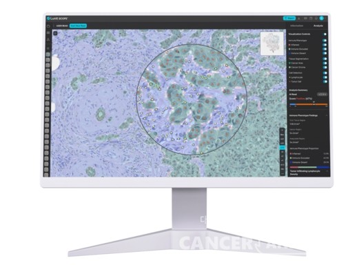 루닛은 최근 미국국립암연구소(NCI)와 인공지능(AI) 기반 암 연구 파트너십을 체결했다고 31일 밝혔다. 의료 인공지능 기업 루닛의 AI 바이오마코인 '루닛 스코프 IO'./루닛 제공