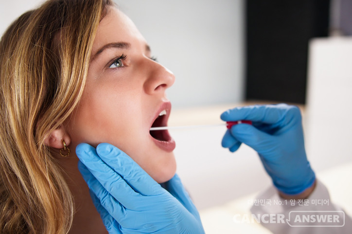 전립선암 발병 위험을 예측하는 데 혈액검사보다 침 검사가 효과적이라는 연구 결과가 나왔다. 간단하고 저렴한 방법으로 전립선암의 유전적 위험성을 찾을 수 있다는 것이다. 영국 런던암연구소의 로스 일즈 교수 연구팀은 전립선암 발병 위험을 높일 수 있는 돌연변이를 찾아내는 타액 검사의 효과를 확인하고 연구 결과를 국제학술지 ‘뉴잉글랜드의학저널(NEJM)’에 9일 발표했다./게티이미지뱅크