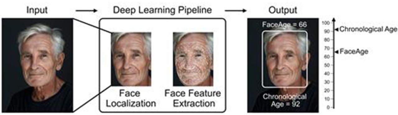 얼굴 사진으로 생물학적 나이를 추정하고 암 치료 예후를 예측하는 인공지능 '페이스에이지'(FaceAge)의 작동 원리. 촬영 사진을  AI로 분석해 생물학적 나이를 예측하고 암환자의 생존율까지 계산해준다. 매사추세츠종합병원 홈피