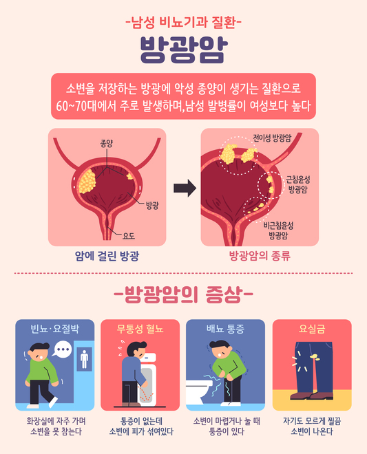 방광암은 초기라도 재발할 가능성이 높은 암이다. 전체 암 중에서 재발률이 매우 높은 편에 속한다.특히 점막과 점막하층에 국한된 초기 단계의 방광암은 1년 내 재발률이 15~61%, 5년 내에는 최대 78%에 이를 수 있다는 연구가 있다. 초기 방광암 수술 후 재발이 예외적인 사례가 아니라는 의미다./게티이미지뱅크