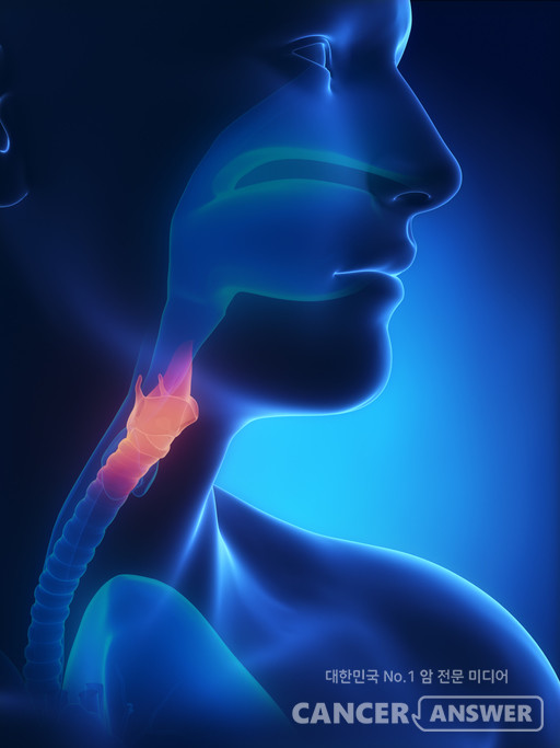 목소리만으로도 후두암(목의 후두에 생기는 암)의 초기 징후를 잡아낼 수 있다는 연구 결과가 나왔다. 미국국립보건원(NIH)의 ‘브릿지투AI(Bridge2AI)’ 프로젝트 연구팀은 사람의 목소리 녹음을 인공지능(AI)에 학습시켜 성대에 이상이 있는지를 구별할 수 있다는 연구를 국제학술지 ‘프런티어스 인 디지털 헬스(Frontiers in Digital Health)’ 최신호에 발표했다./게티이미지뱅크